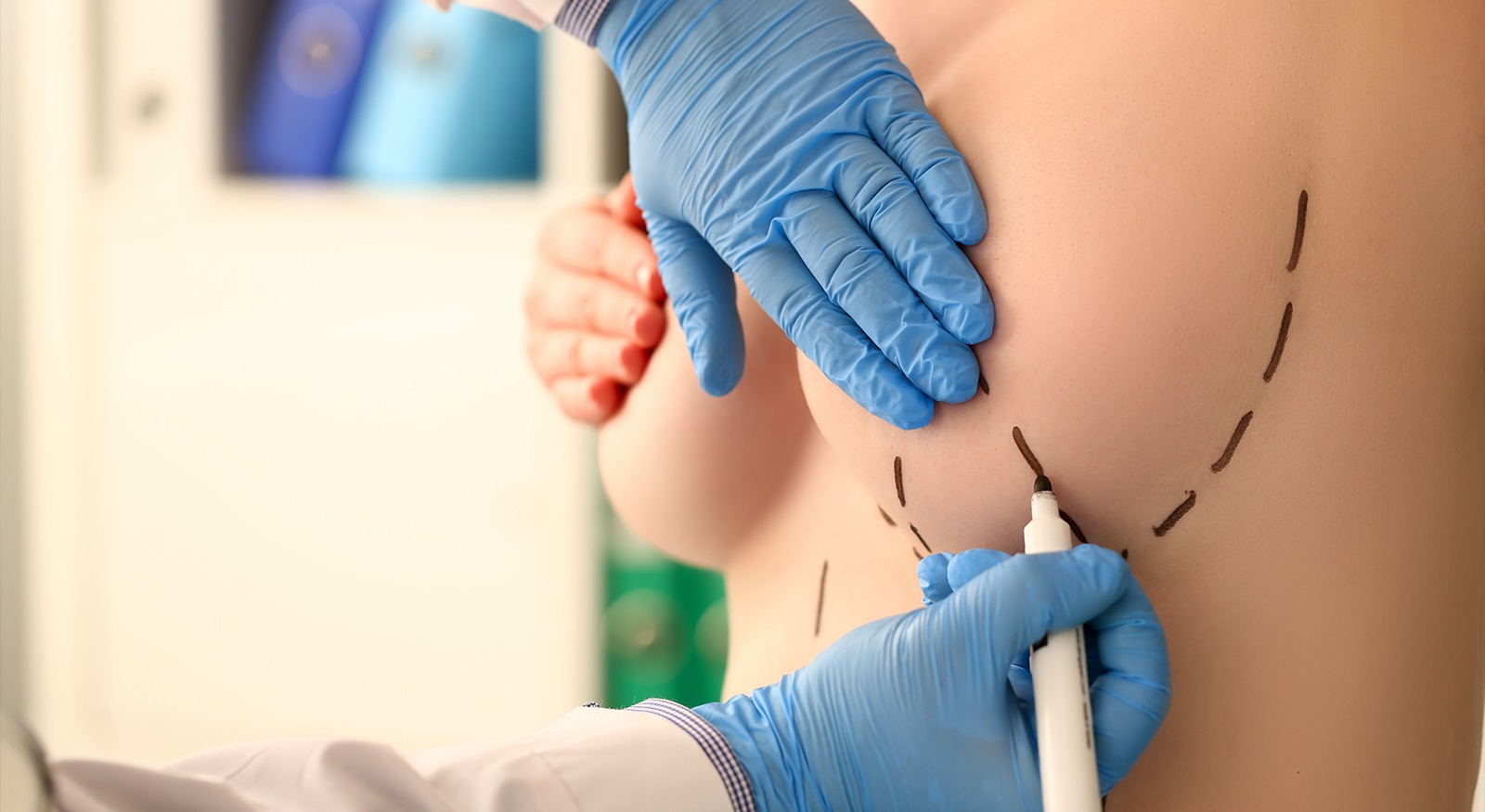 breast-reduction-surgery-in-india-cost-treatment